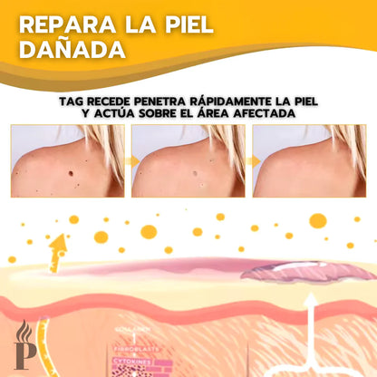 💧🔥 TAG RECEDE ELIMINADOR DE VERRUGAS 🔥💧